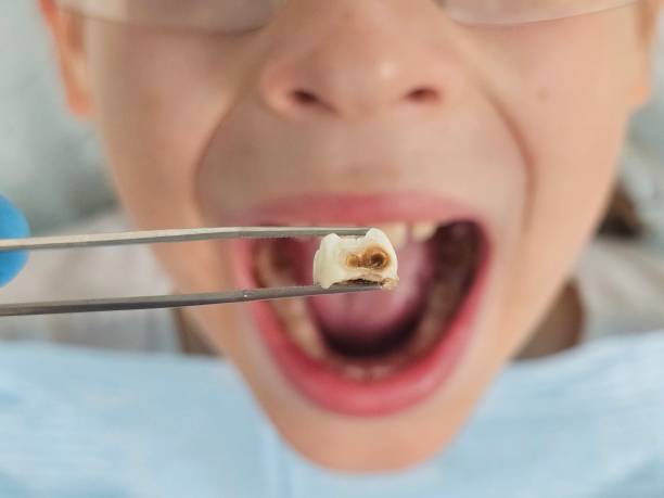 Best Orthodontic Emergency Dentist in Hays, MT